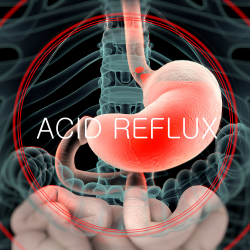 Acid Reflux (GERD)
